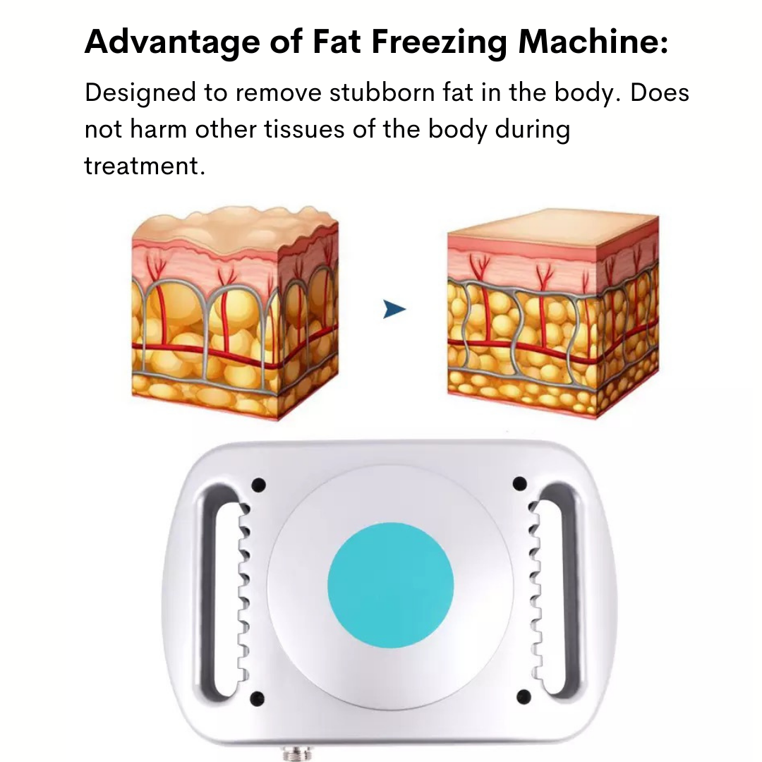 Cryolipolysis fat freeze belt 240v sale