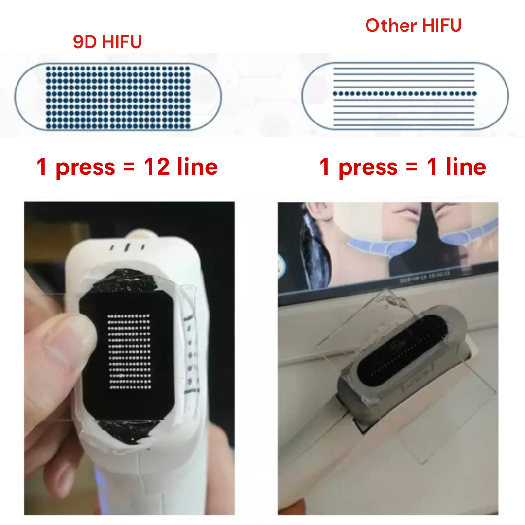 Máquina HIFU de estiramiento facial 9D