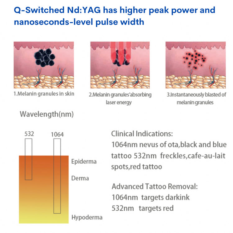 How a switched nd:YAG has super pulse and pulse