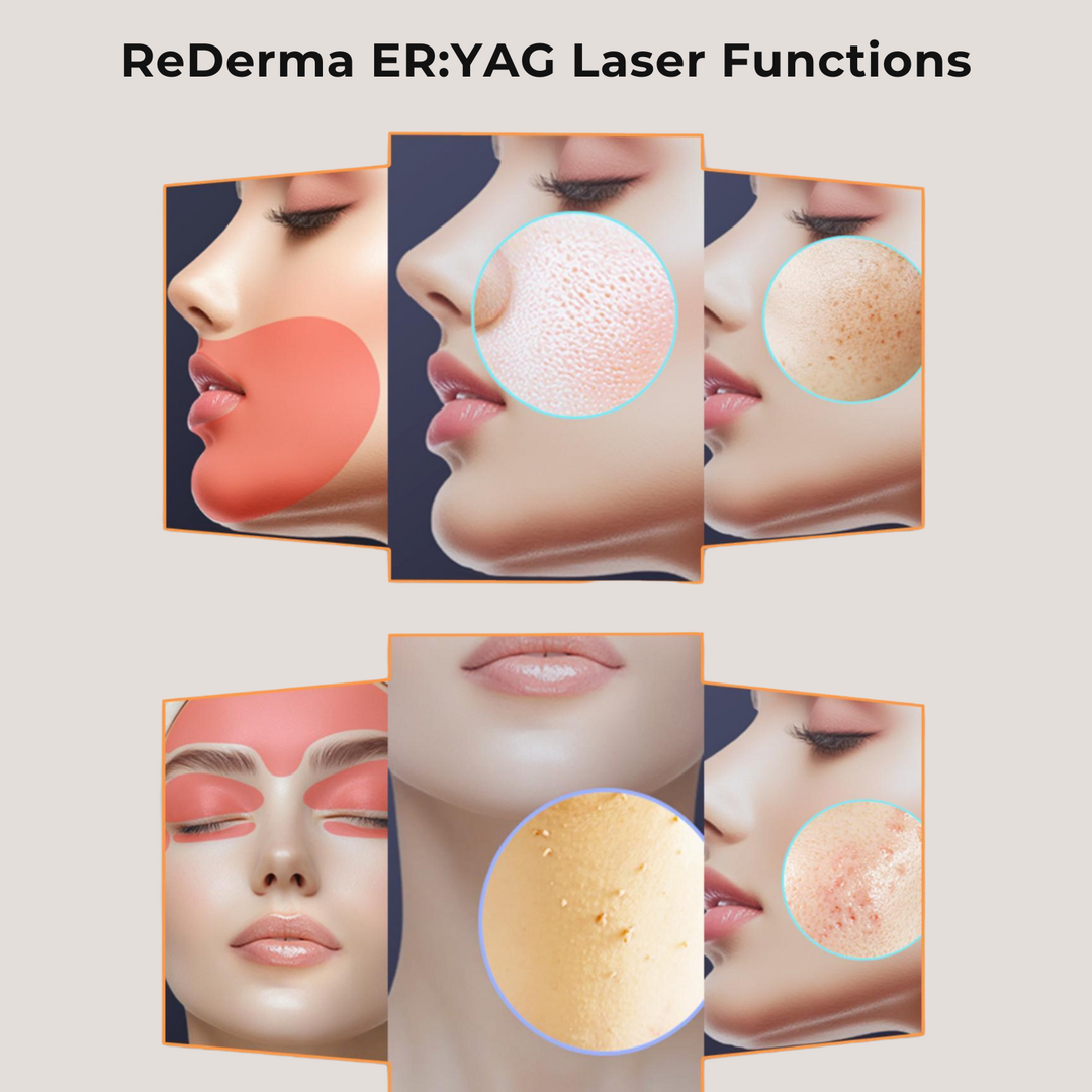 ReDerma ER Superior Absorption Erbium Laser