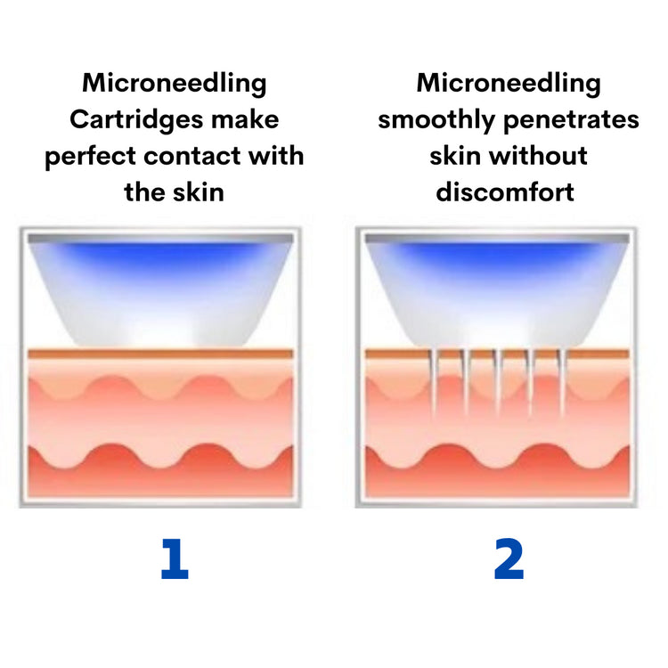 microneedling penetrates skin treatment 