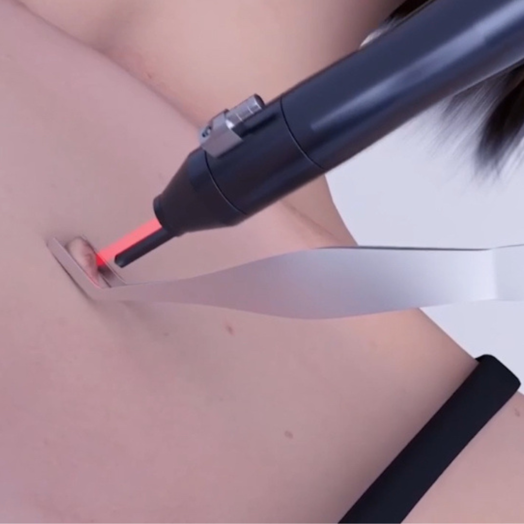 SmartPulse™ COOL Professional CO2 Fractional Laser