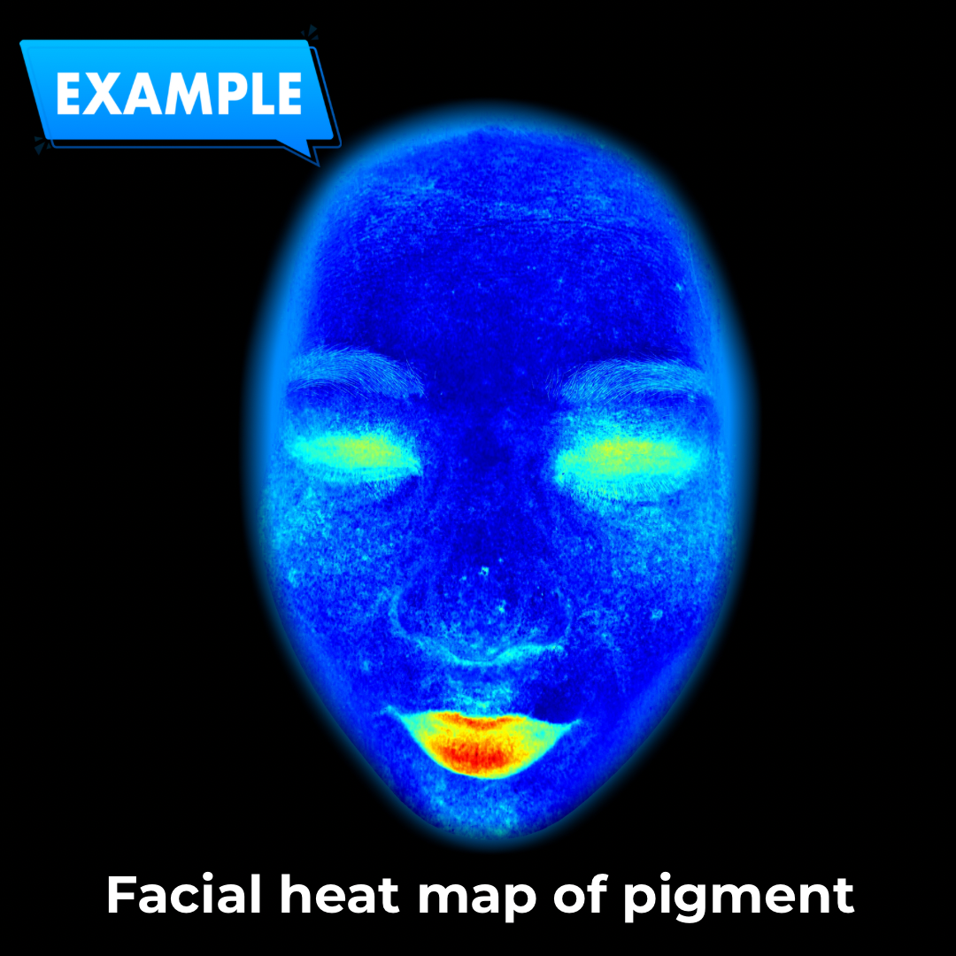 Imagica™ Skin Analyzer & Sharing System