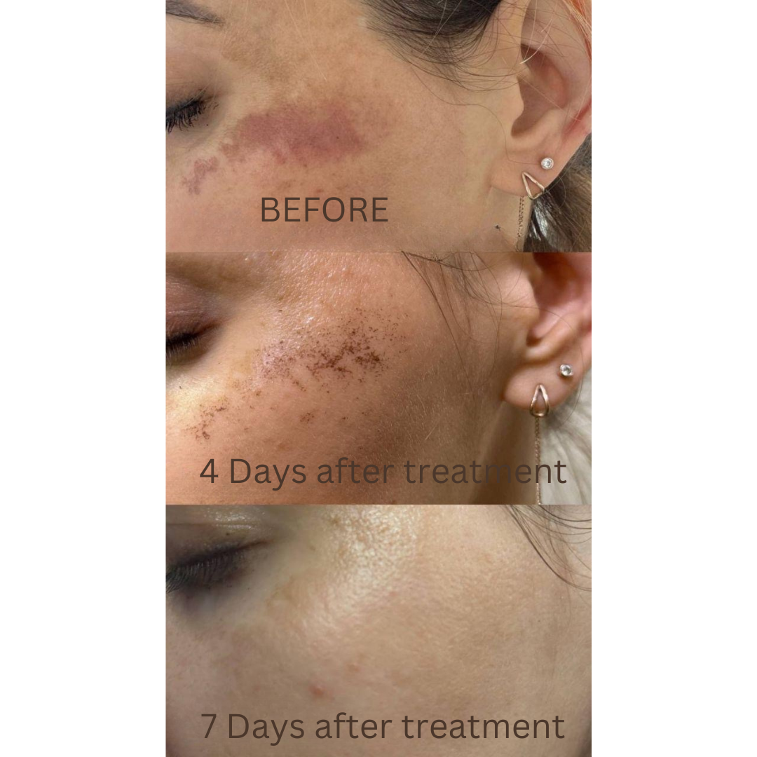 DuoSmooth™ 2-in-1 Diode Laser + IPL System