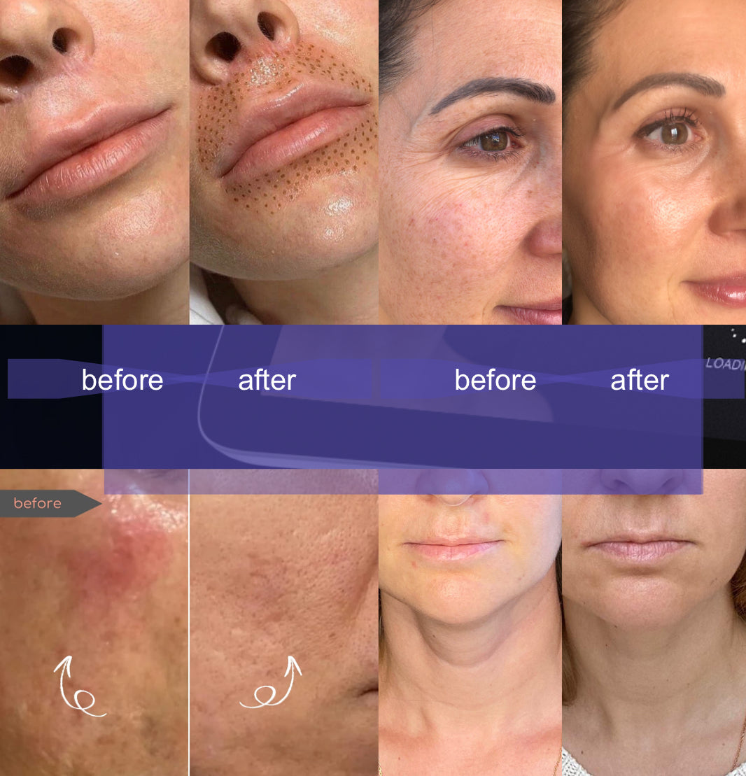 Ionic Beauty 8D - Multifunction Cold & Warm Plasma Machine