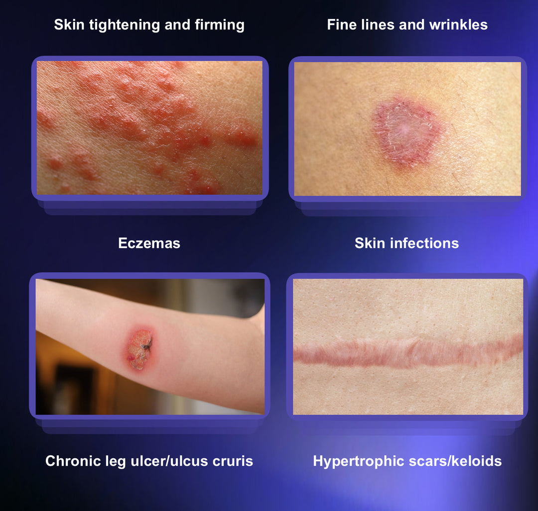 Ionic Beauty 8D - Multifunction Cold & Warm Plasma Machine