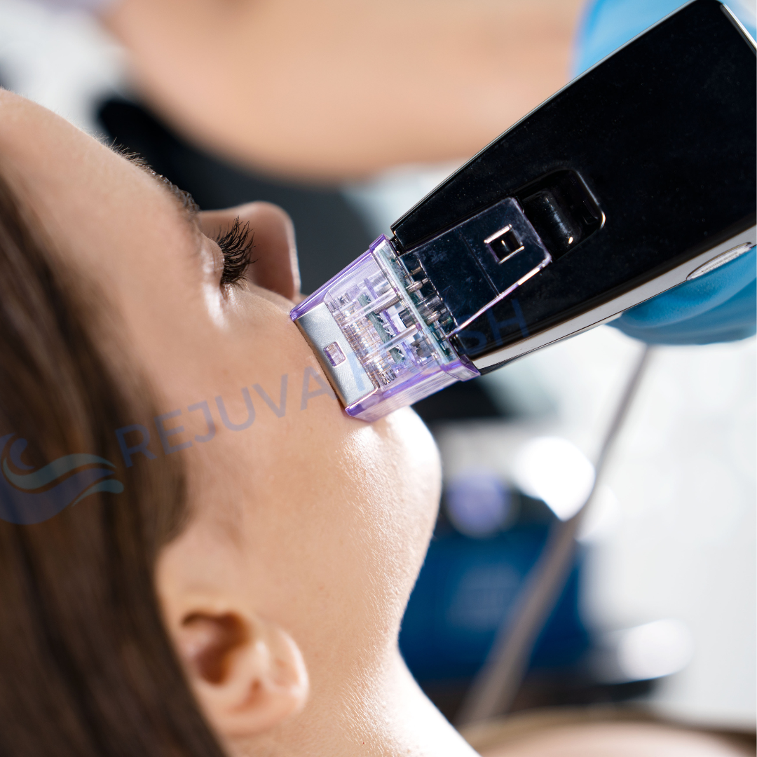 Metamorph8.5™ Golden Youth RF Microneedling Machine