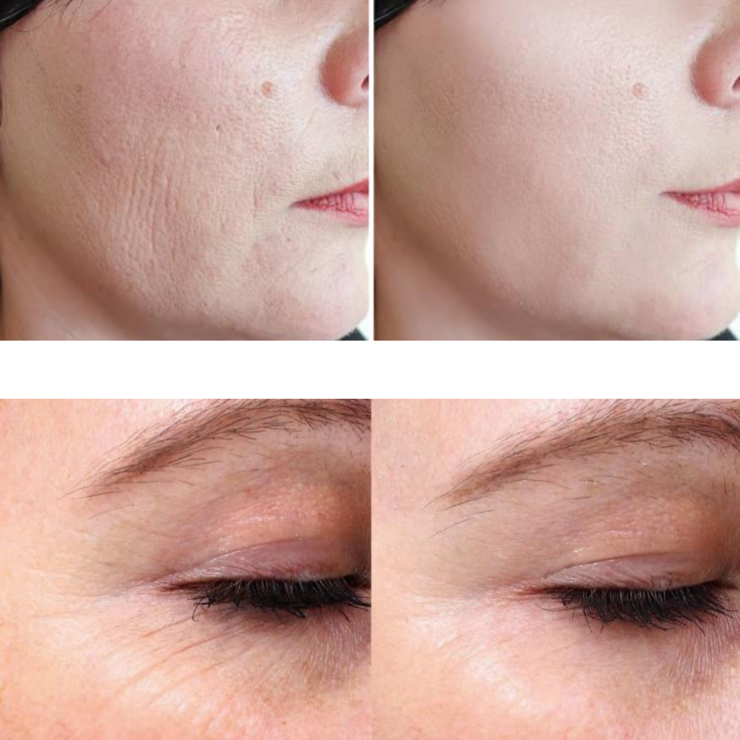 Eris Lipo Cavitation Machine 9 en 1 Professionnelle